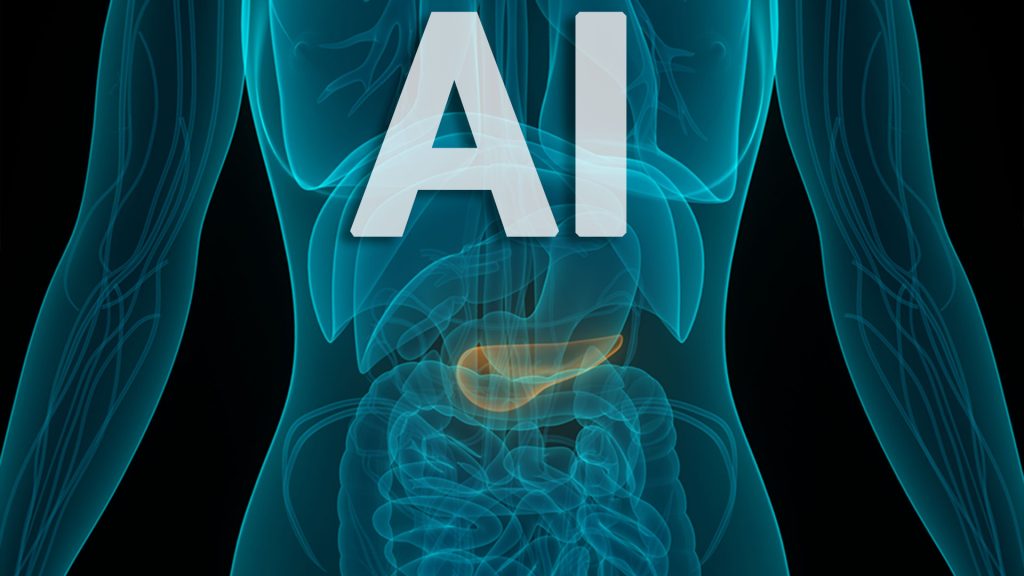 تشخیص سرطان پانکراس با هوش مصنوعی